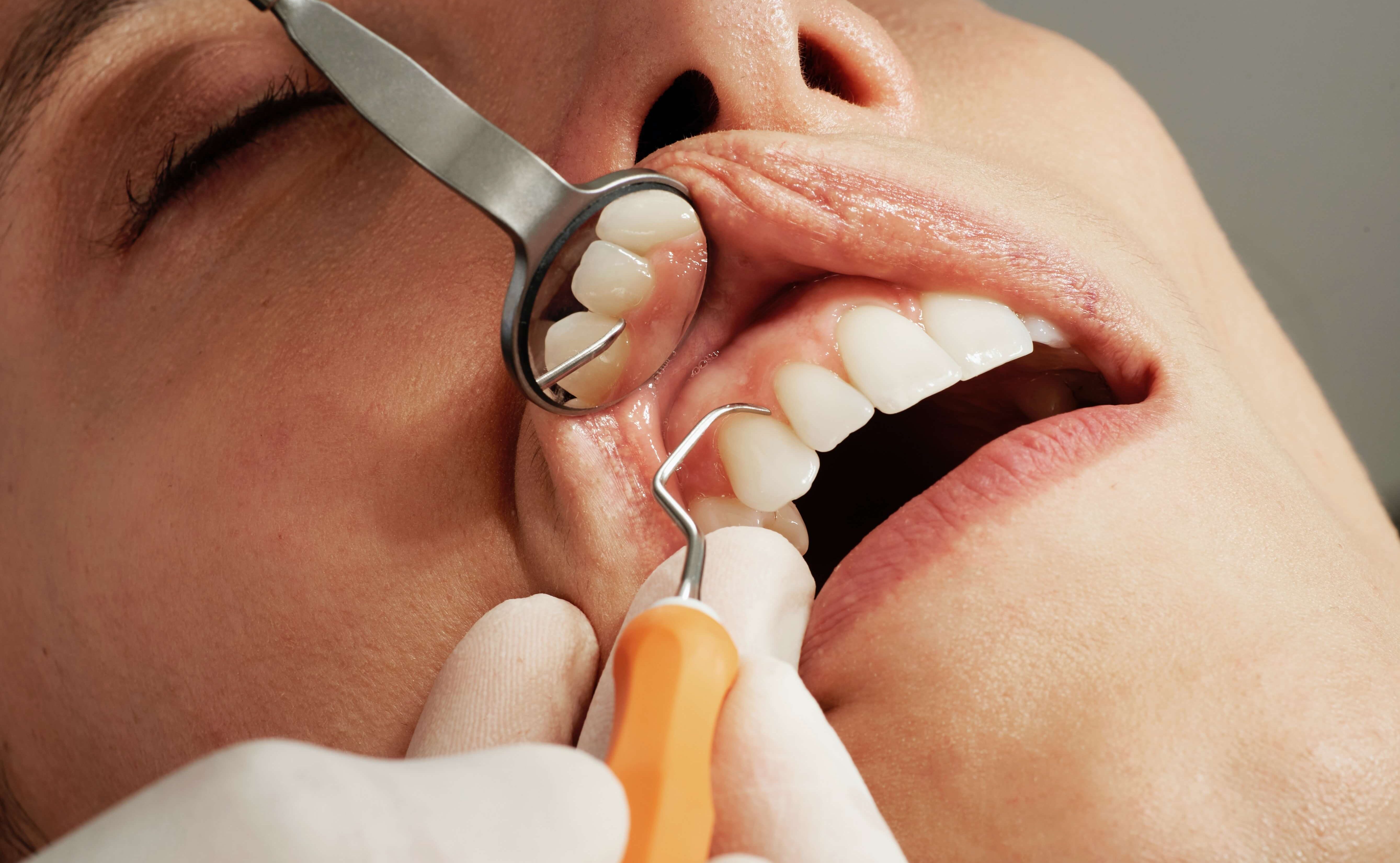 Dental Checkup