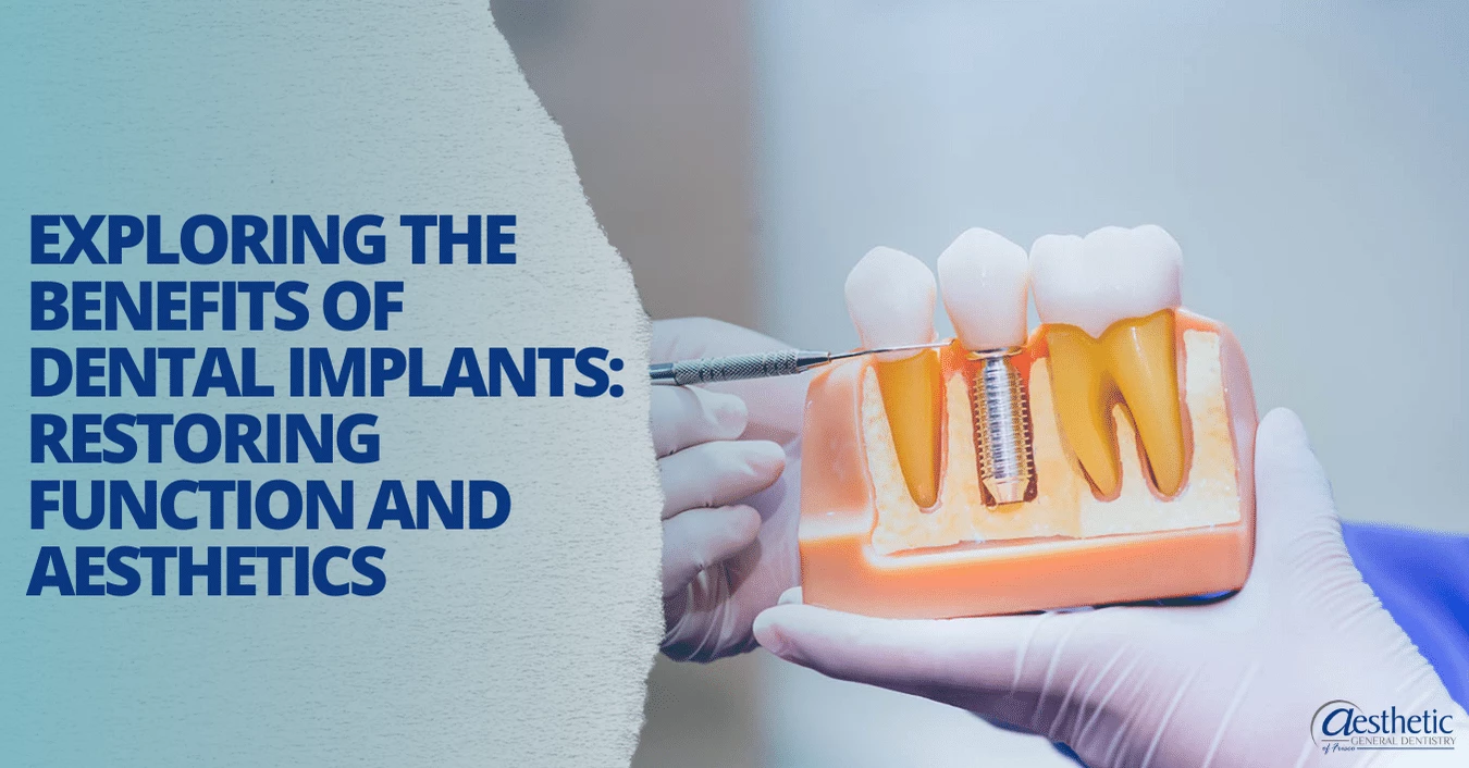 Dental Implants