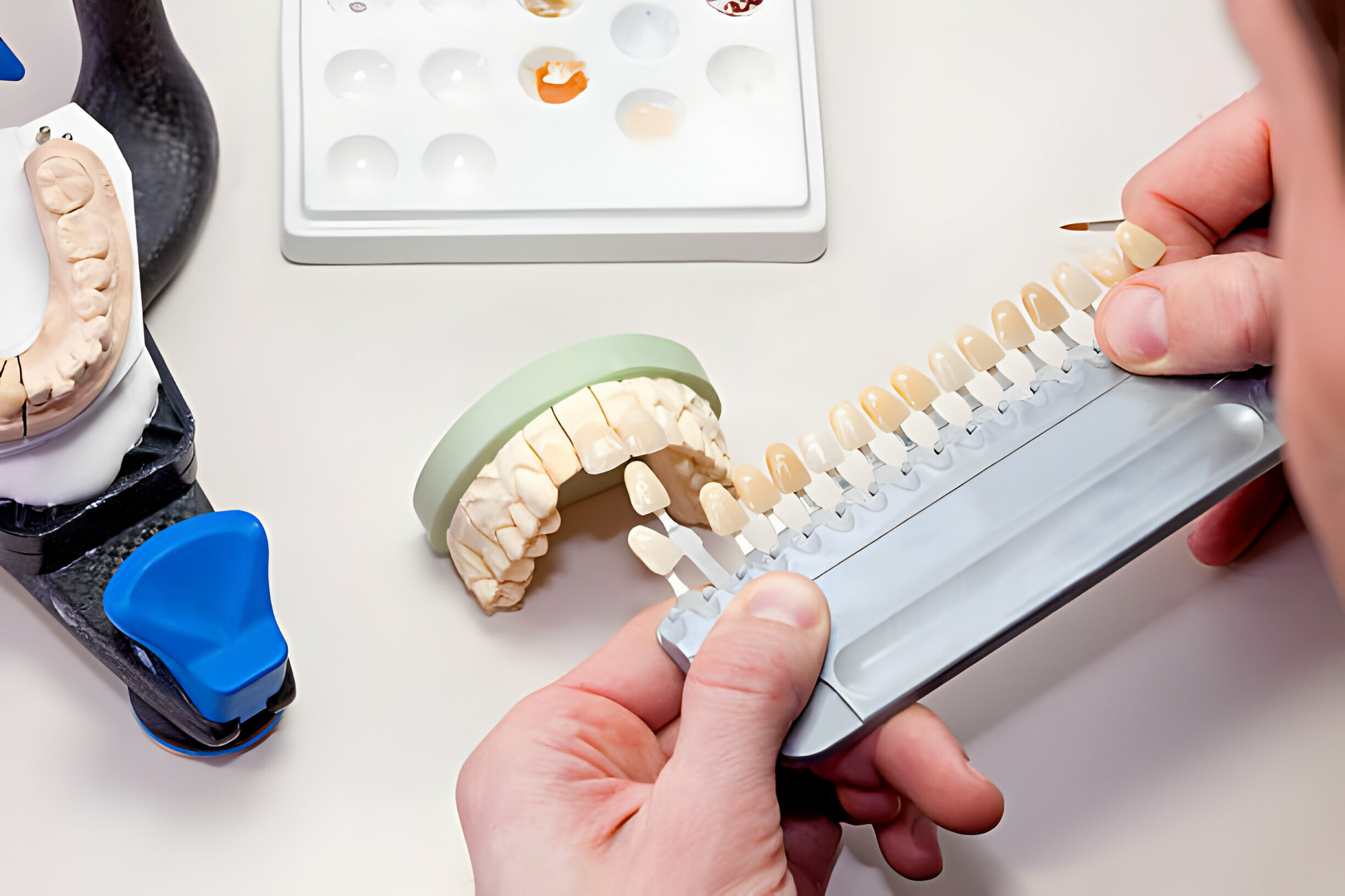 Dental Implants