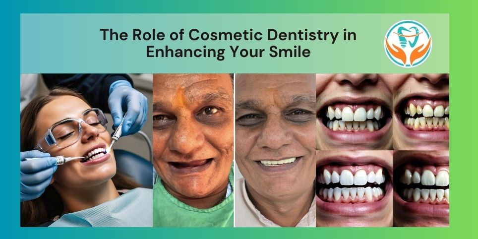 Enhancing Your Smile